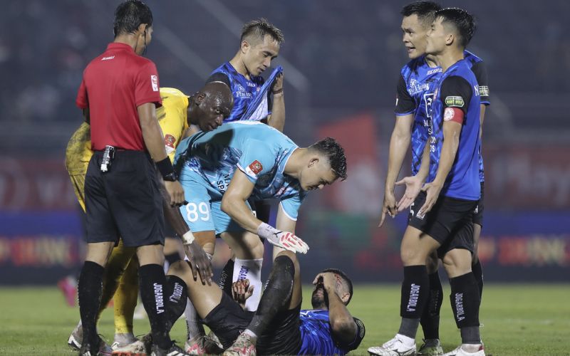 Chấn thương cơ háng khi đá bóng gây đau vùng háng của cầu thủ