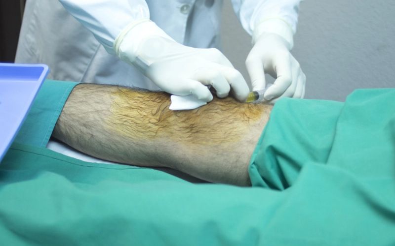 Vị trí chấn thương ống đồng khi đá bóng ở vùng cẳng chân cầu thủ